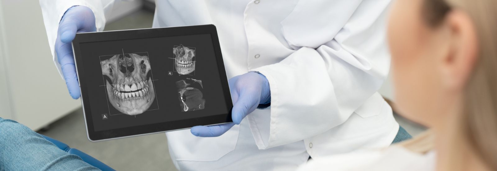 Dental 3D X-ray