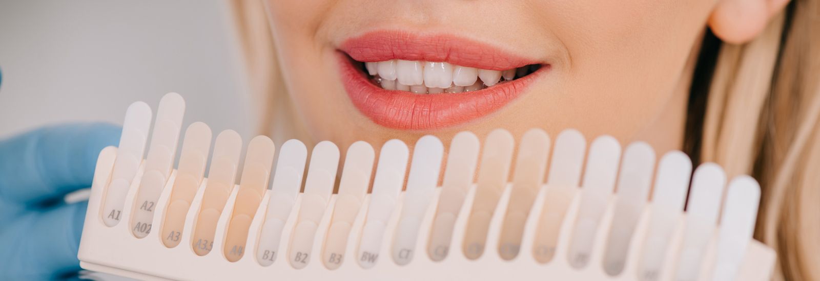 Teeth whitening color chart